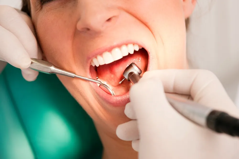 endodontics