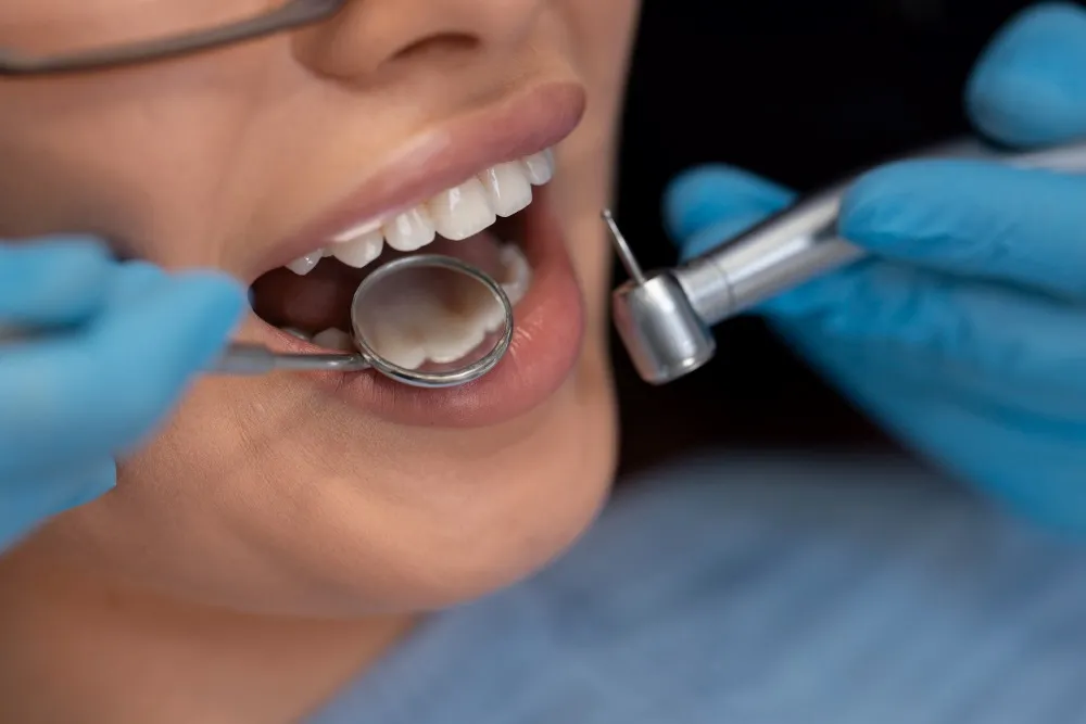 Teeth Crowns Turkey