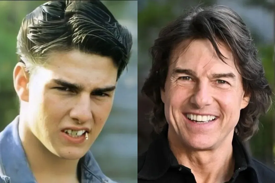 Tom Cruise Teeth: Before, After & Dental Work