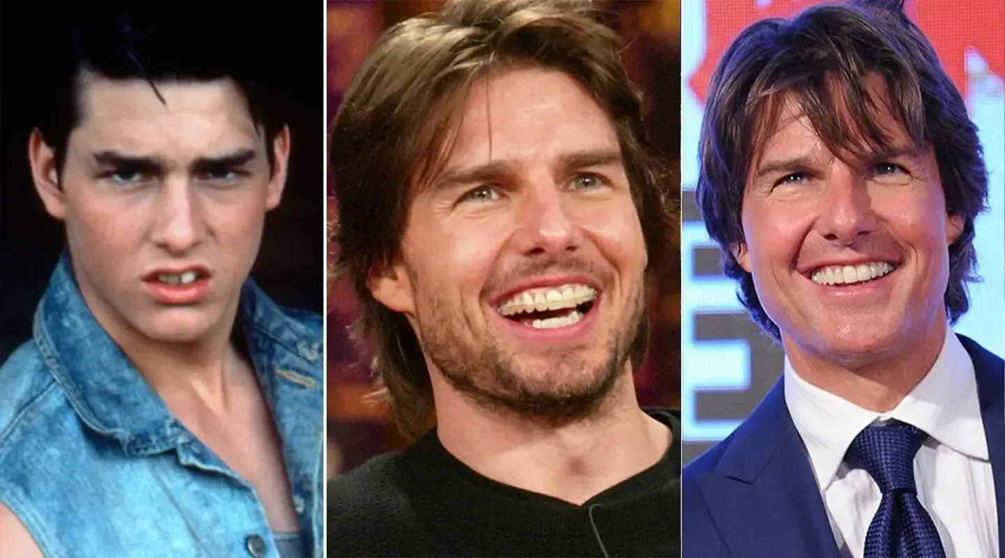 Tom Cruise Teeth: Before, After & Dental Work