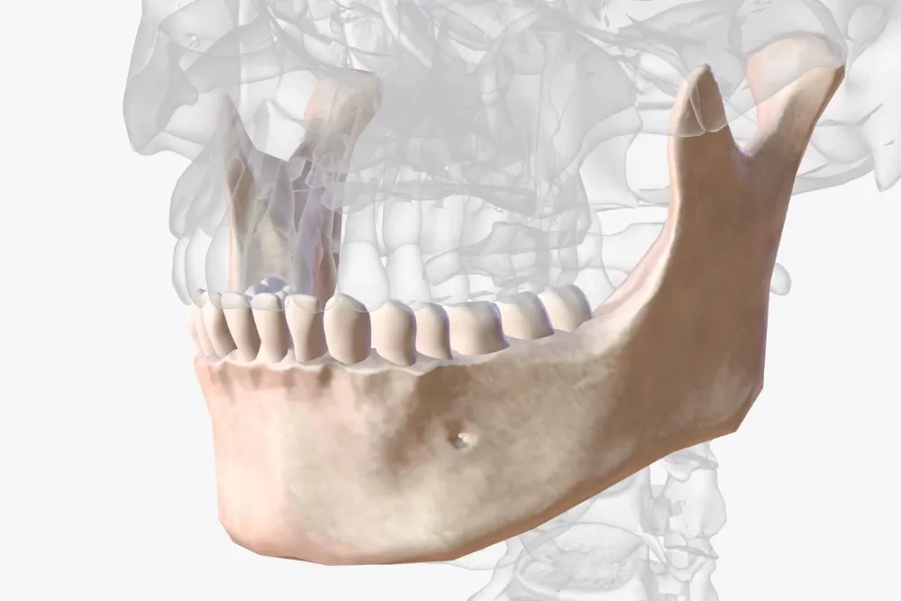alveoloplasty surgery