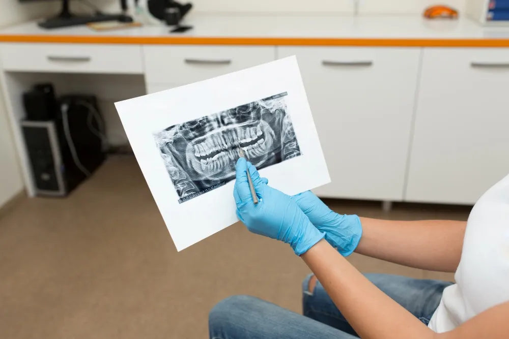 dental x-ray