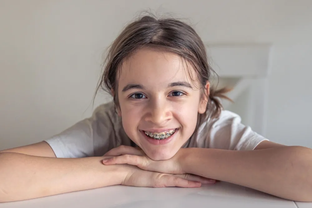 Diş Teli Tedavisi Nedir? Nasıl Uygulanır?