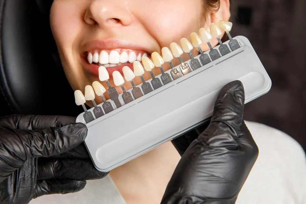 Emax Veneers Türkei