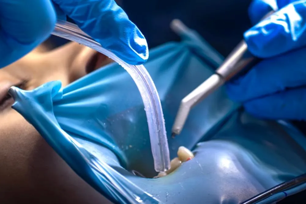 Flap Treatment