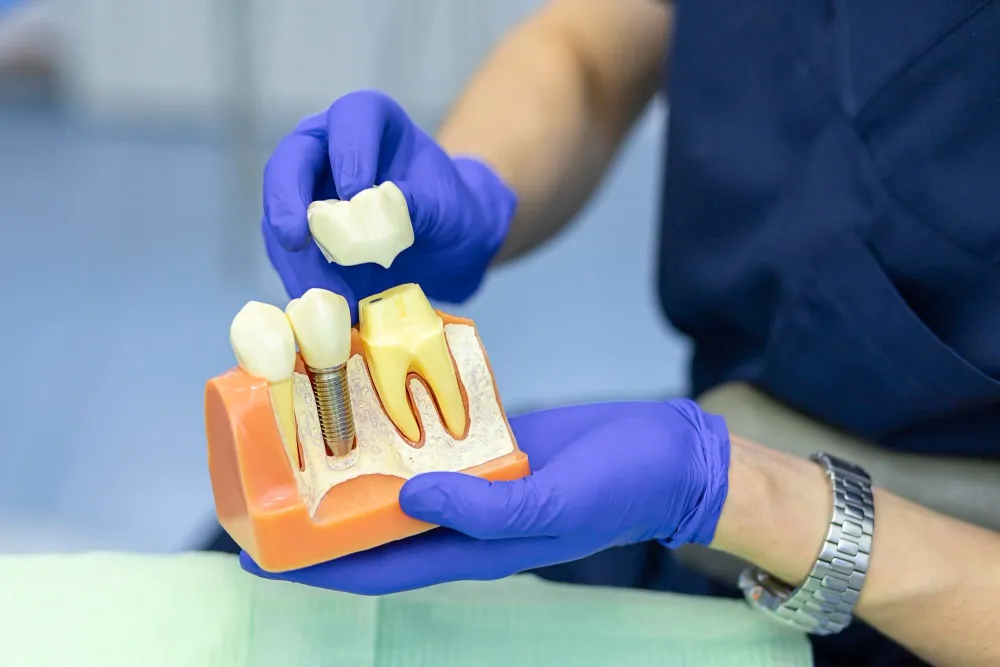 What is Dental Implant Treatment? How is it Performed?