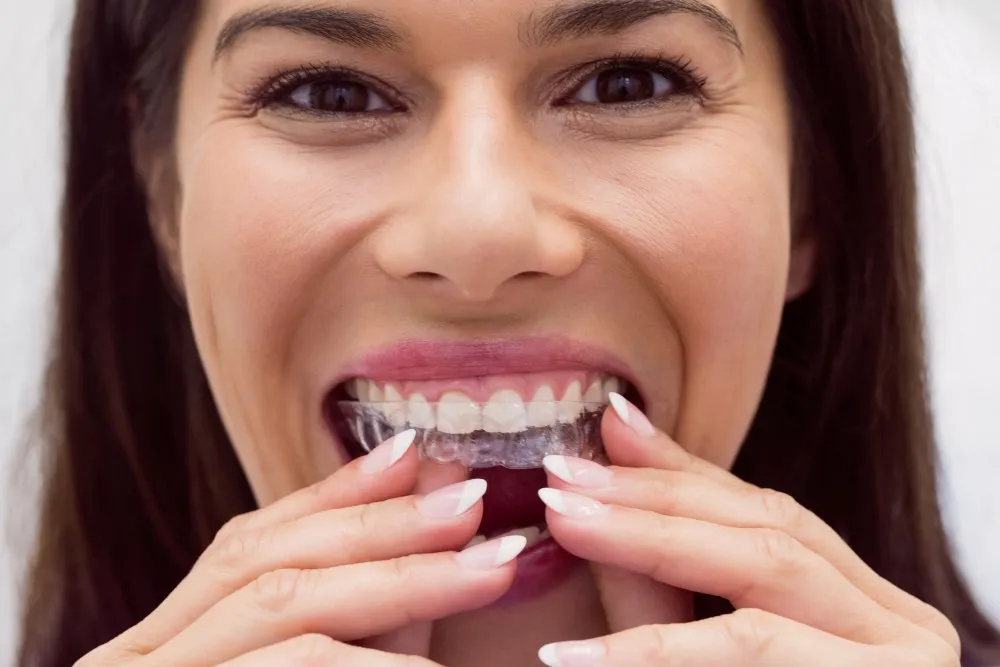 Invisalign Turkey