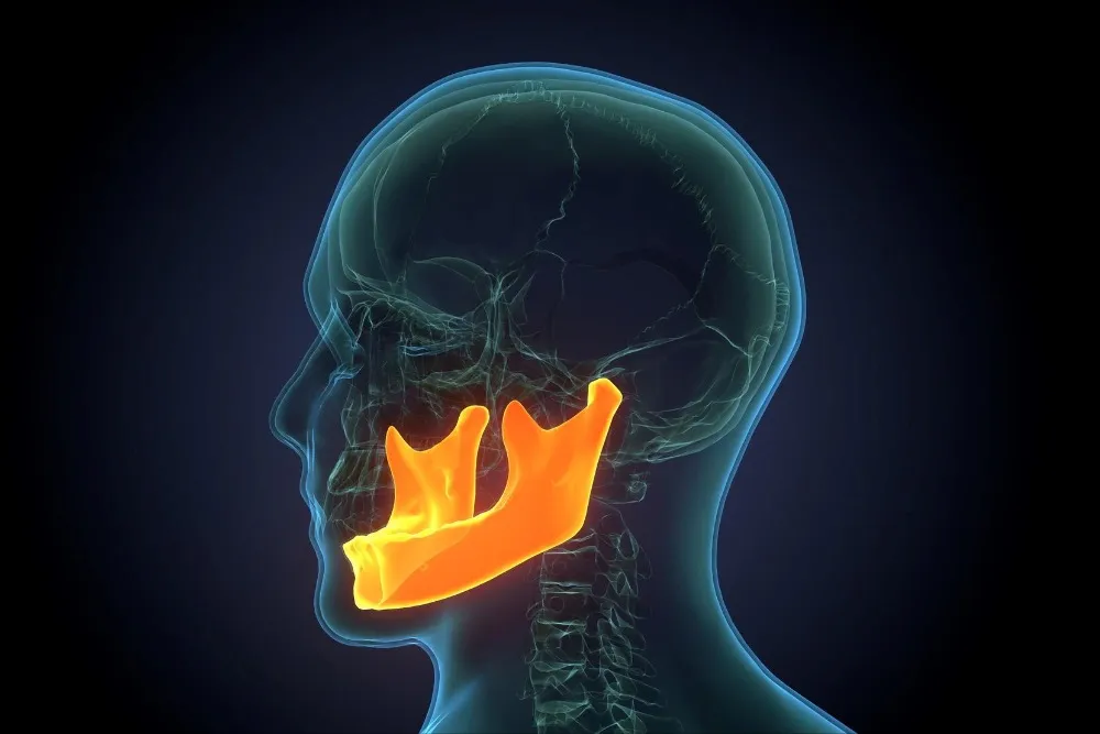 fractured jaw