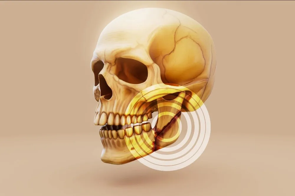 jaw fracture