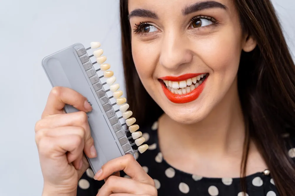 laminate veneers