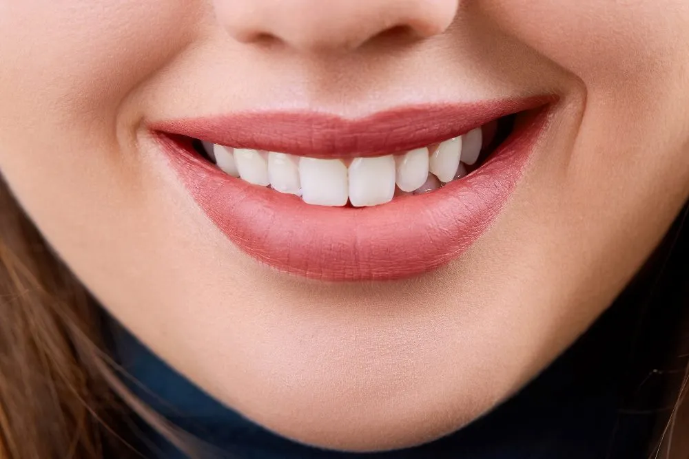 smile design prices