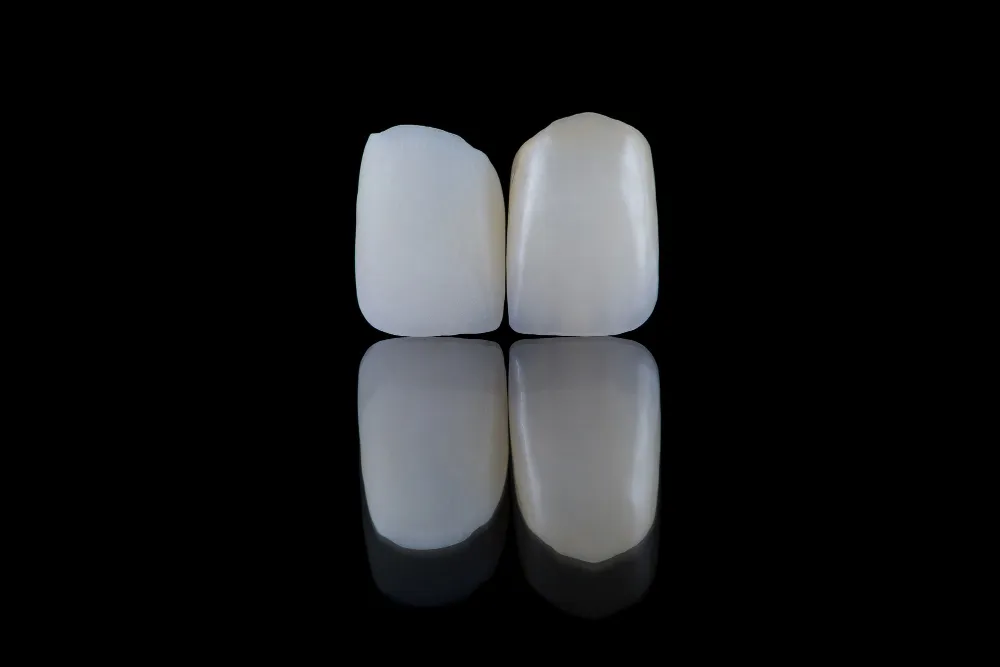 Zirconium crowns biocompatibility