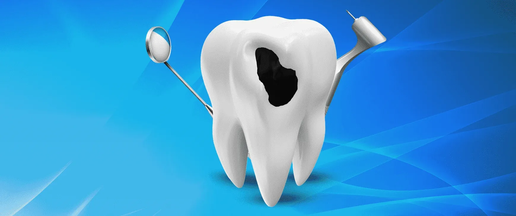 What Is Dental Filling? How Is It Done?