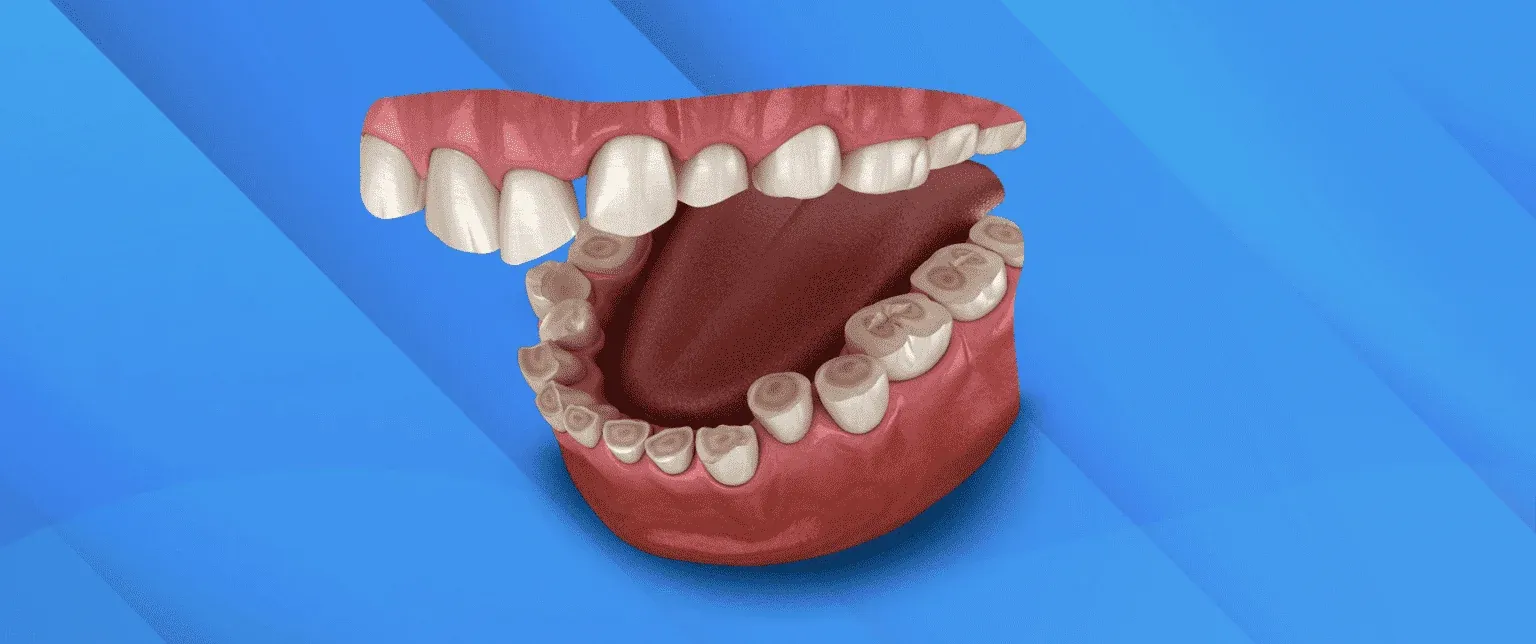 Diş Sıkma (Bruksizm) Nedir? Nasıl Tedavi Edilir?