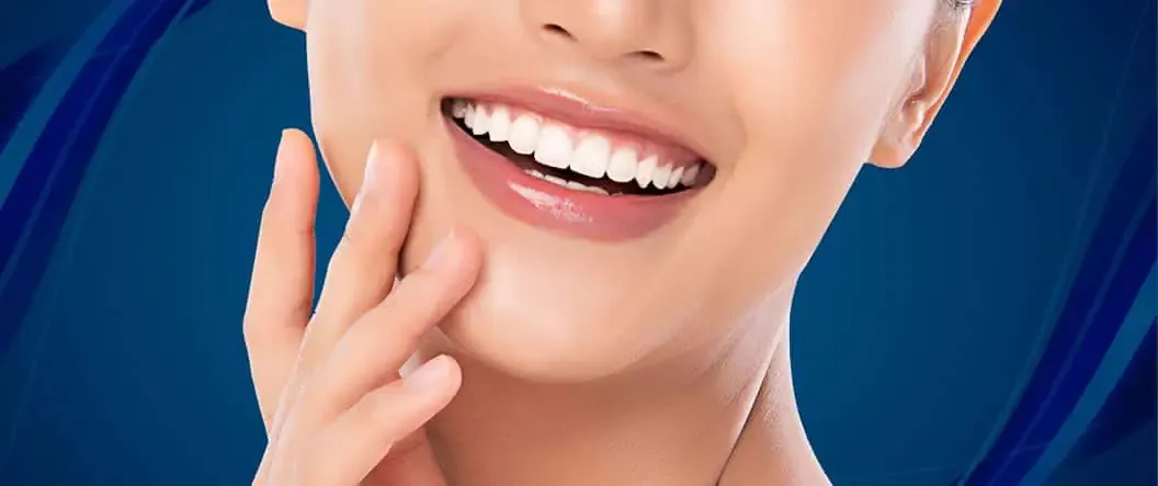 Hollywood Smile (Gülüş Tasarımı) Nedir?