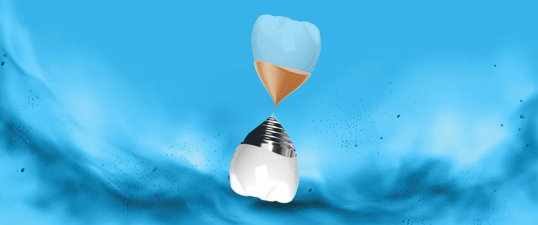 What is Implant in 1 Day? How Does It Work?