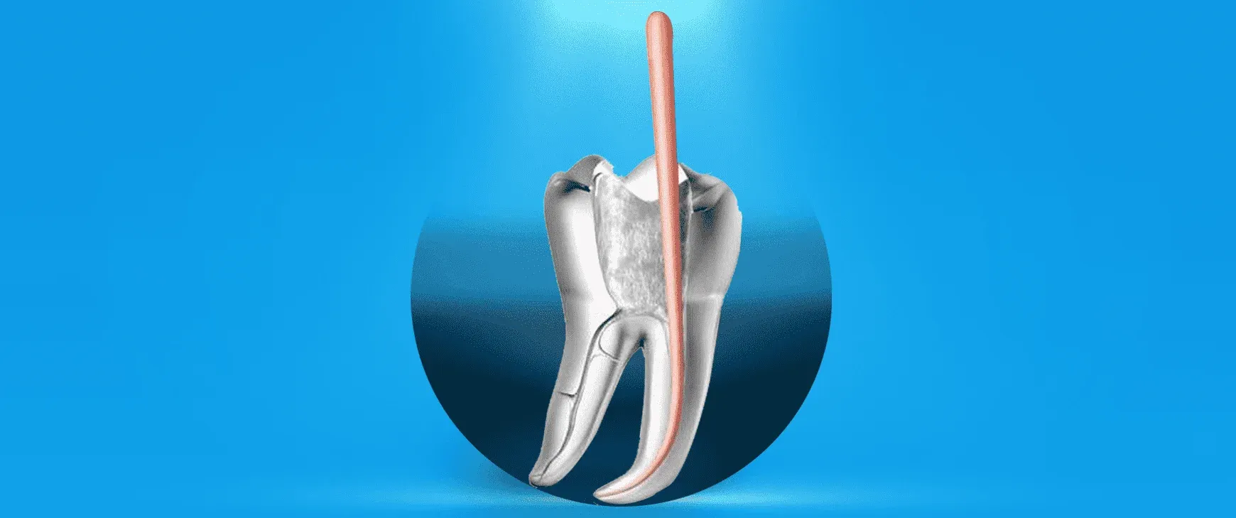 A Guide to Root Canal Treatment: What to Do?